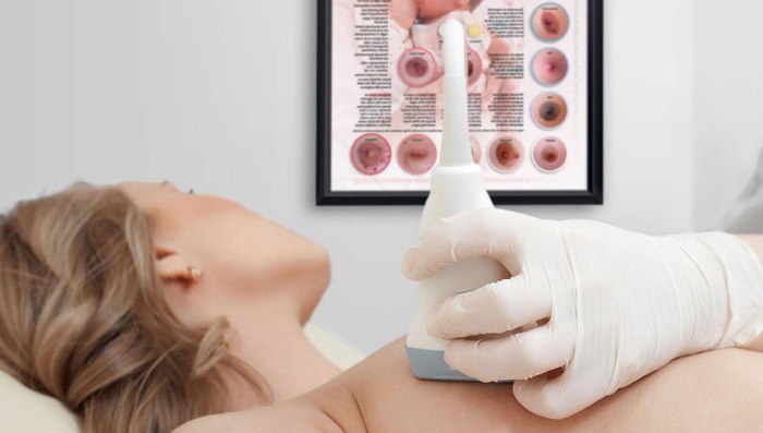 УЗД молочних залоз