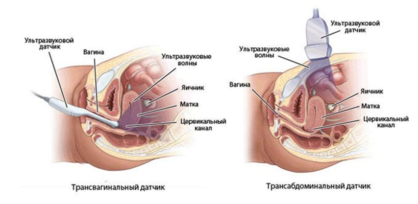 Сделать УЗИ органов малого таза в Москве недорого, цены на УЗИ малого таза у женщин и мужчин